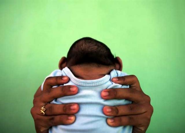 أول طفل يولد بصغر فى الرأس، بسبب فيروس زيكا، البرازيل، 11 فبراير 2016. - صورة أرشيفية