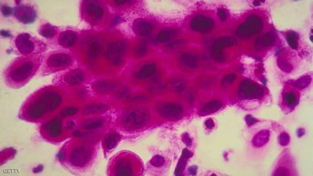 خلية قادرة على القضاء على معظم أنواع السرطان