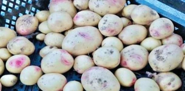 مفاجأة عن بقع البطاطس.. تعرف على التفاصيل